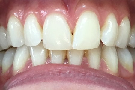 Smile Gallery