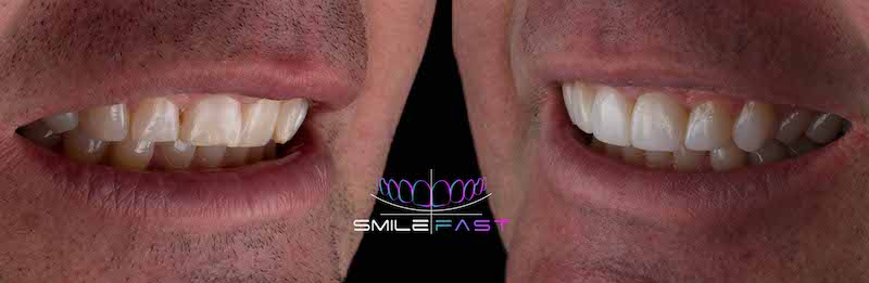 Before After Example 3