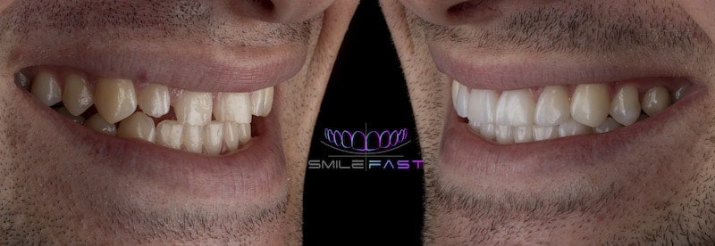 before after example 2